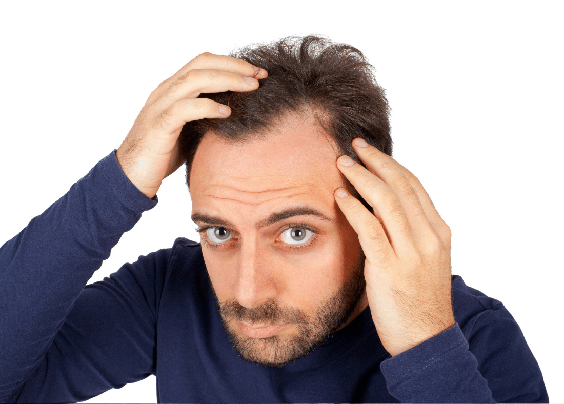 hair loss